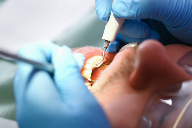 Best Dental Abscess Treatment in Konterra, MD