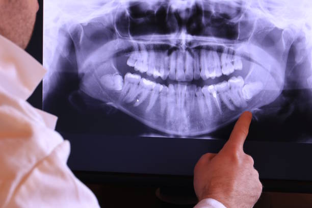 Best Emergency Wisdom Tooth Extraction in Konterra, MD